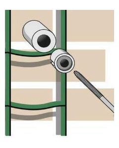 Panofix groen 20mm - 6 stuks